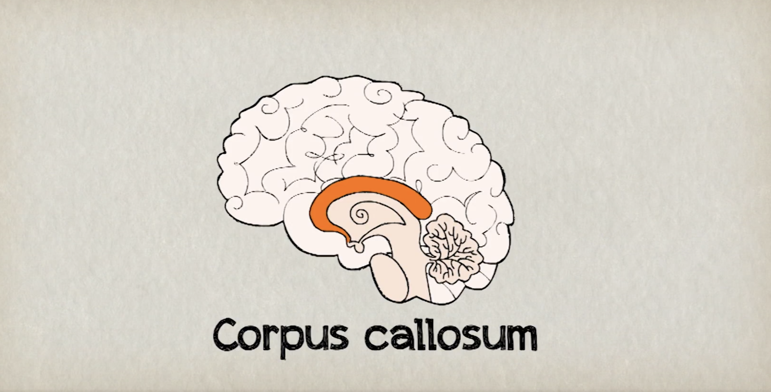 Corpus Callosum