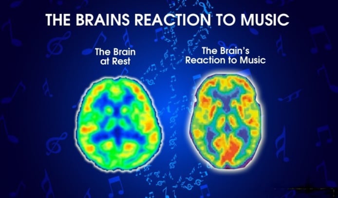 How Does the Brain React to Playing an Instrument